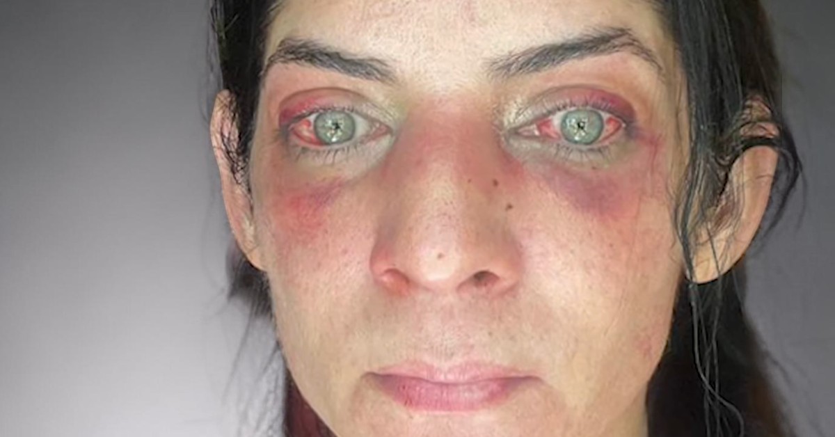 «Vi la muerte de frente» (video)